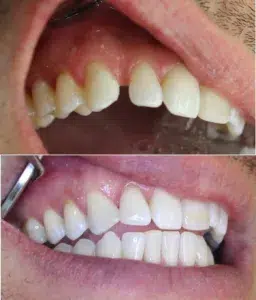 rs=w_1160,h_1357 (1)